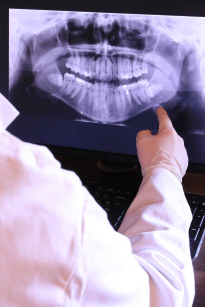 Best Emergency Root Canal Treatment in Hines, OR