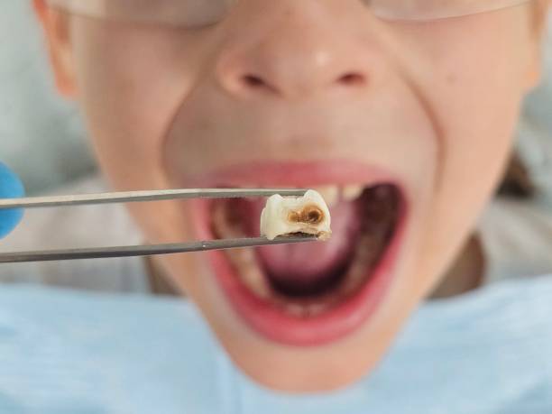 Best Emergency Treatment for Toothache in Hines, OR